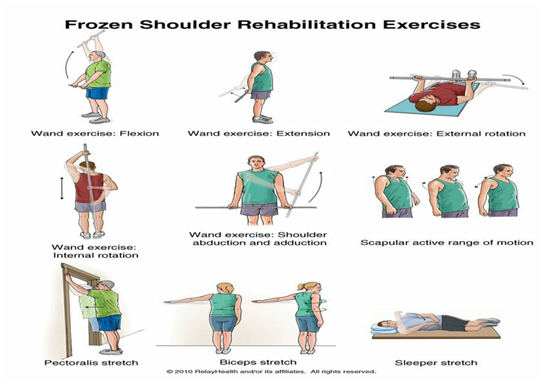 FROZEN SHOULDER - Best physiotherapy Clinic in Gurgaon - PhysioMannat